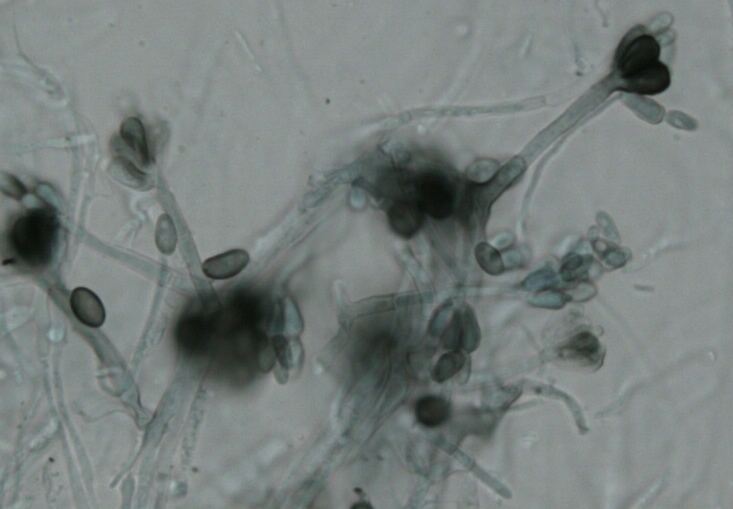 Black Mold Stachybotrys