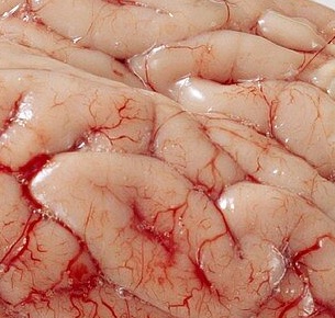 Cerebrum suis & Hypothalamus suis